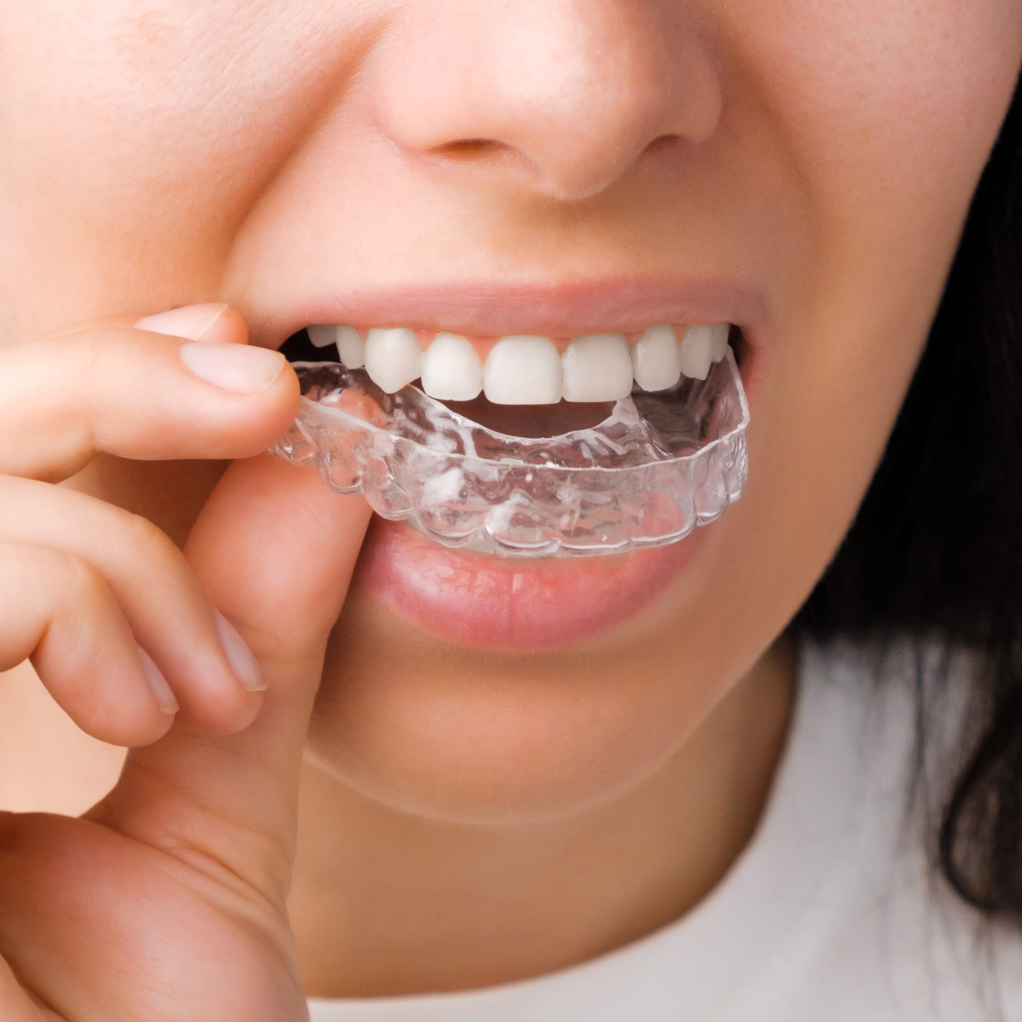 ortodoncia invisible