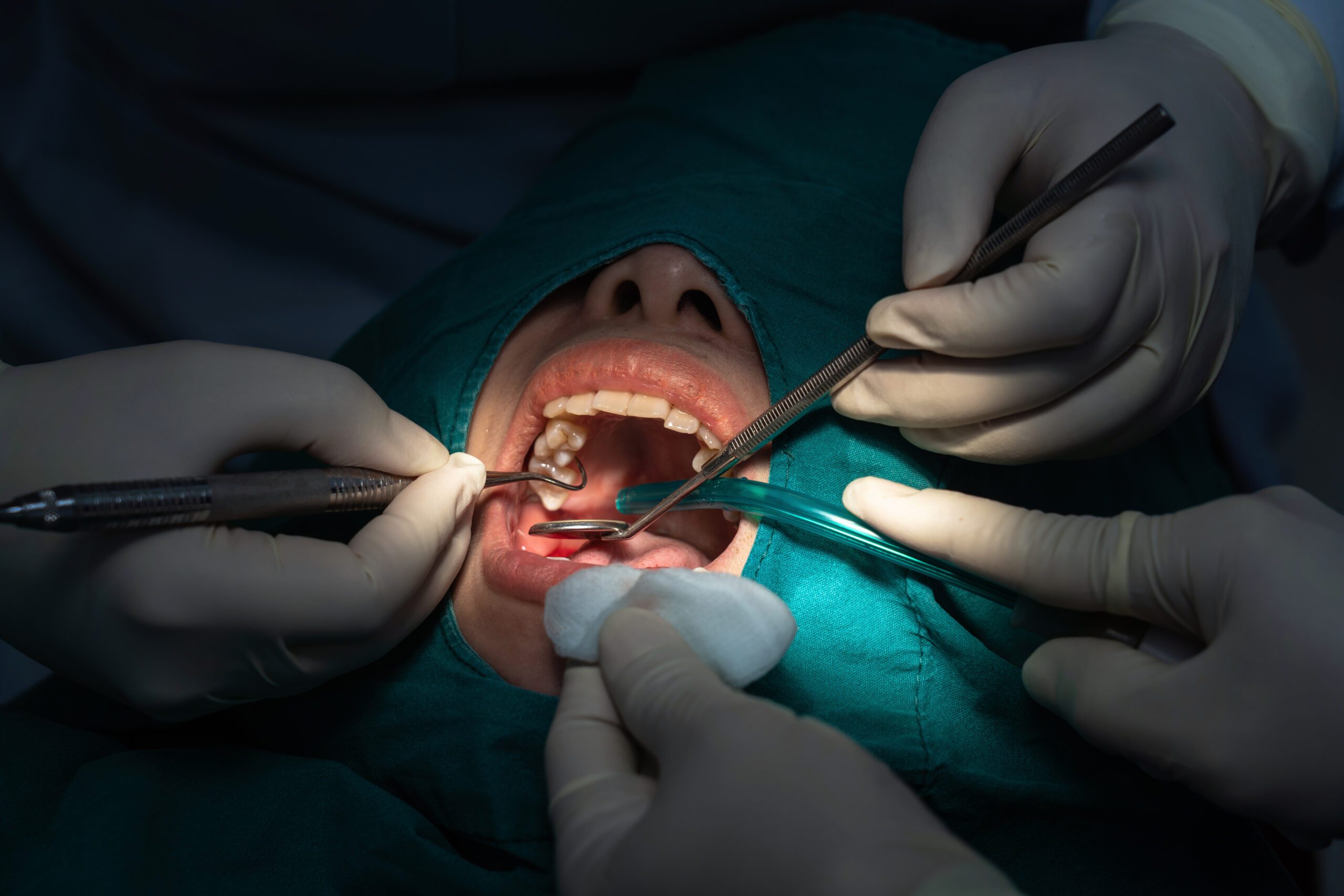 prevenir las caries